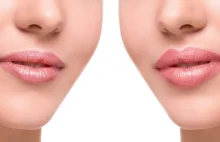 Jakie są powikłania po powiększaniu ust?