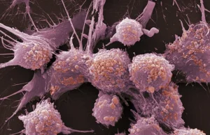 Opracowano nową, mało inwazyjną metodę walki z nowotworami