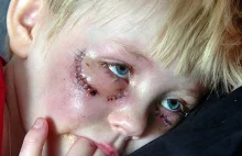 Szwedzkie dziecko pobite przez Islamistę bo miało niebieskie oczy.