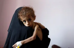 Klęska głodu w Jemenie: 500 tys. dzieci nie dożyje następnych urodzin