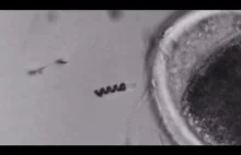 Microbot pobiera plemnik i wsuwa do środka komórki jajowej - Cud Życia