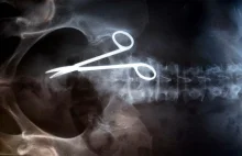 Najbardziej frapujące zdjęcia rentgenowskie | Somatyczny - blog...