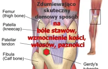 Zdumiewająco prosty domowy sposób na bóle stawów i zatrzymanie wypadania włosów