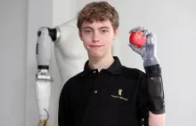 Czternastolatek wysłał list i dostał zaawansowaną technicznie protezę