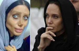 Chce wyglądać jak Angelina Jolie. Mówi, że przeszła 50 operacji
