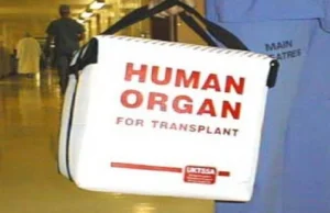 USA: jeden dawca pomógł setce osób. Transplantolodzy: to ewenement na...