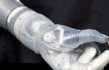 DEKA: Bioniczne ramię uzyskało aprobatę FDA