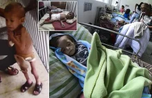 Wenezuela: Dzieci umierają z głodu, a Maduro blokuje pomoc humanitarną