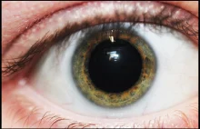 Co widzi specjalista podczas badania dna oka?
