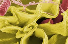Salmonella niszczy komórki rakowe jak koń trojański
