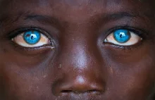 Afrykańskie dziecko z plastikowymi oczami