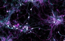 Udało się sztucznie wyhodować dorosłe neurony