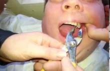 Domowy dentysta