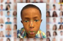 System rozpoznawania twarzy pomoże w diagnozowaniu rzadkich chorób genetycznych