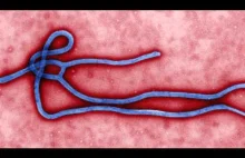 Co czyni wirusa Ebolę tak niebezpiecznym?