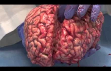 Prezentacja mózgu usuniętego właśnie podczas autopsji