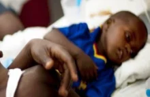 ONZ: 800 tys. dzieci zmarło w 2018 r. z powodu zapalenia płuc