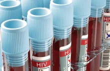 Coraz bliżej powstania szczepionki na HIV