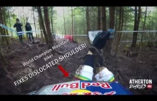 Rachel Atherton nastawia sobie wybity bark (po małej wywrotce na rowerze).