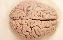 Mózg podzielony