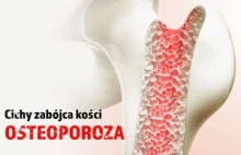 Cichy zabójca kości - Osteoporoza