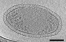Najmniejsza bakteria na świecie ma już swoje zdjęcie!