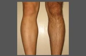 Czy mężczyźni powinni golić nogi? (Debata, Sonda)