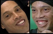 Ronaldinho doczekał się nowych zębów [reportaż]