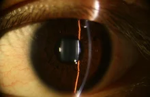 Biomikroskopia gałki ocznej z perspektywy specjalisty