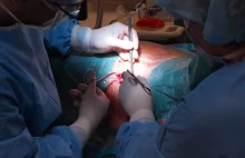 ​Chirurg zostawił 15-centymetrowe szczypce w brzuchu kobiety