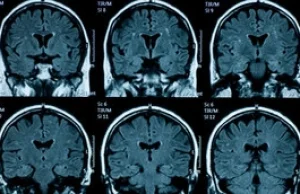 Kanada - używając niedrogiego aparatu EEG naukowcy odkryli sposób na wykrycie...