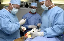 Transplantacja głowy w Rosji będzie kosztować 10 mln euro