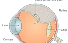 Dwóch niewidomych mężczyzn częściowo odzyskało wzrok!