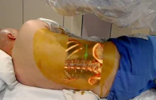 FDA zaakceptowała Microsoft HoloLens do użyciu w chirurgii
