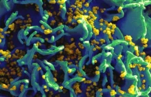 Szczepionka przeciwko HIV