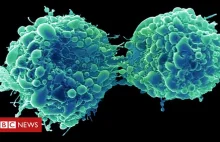 Wirus przeziębienia po modyfikacji zabija raka pęcherza