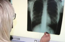 Chorzy z rakiem płuc: Czujemy się jak pacjenci drugiej kategorii