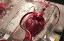 W tym urządzeniu serce może bić po śmierci. Przełom w przeszczepach