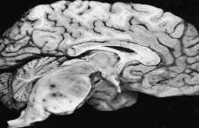 Odkryto nieznane dotąd kanaliki między czaszką a mózgiem