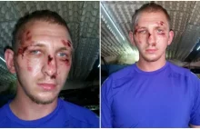 Policjanci po służbie w Słupsku skatowali młodego mężczyznę!