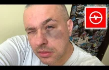 Youtuber pobity przez swoją dziewczynę. Fake wielki jak stodoła?