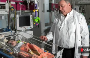 Prof. Cichoń, wybitny kardiochirurg nazywany "lepszą wersją Religi"