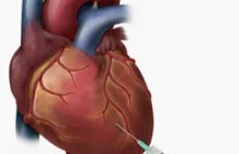 Rewolucyjny zabieg na sercu – wsteczna terapia genowa