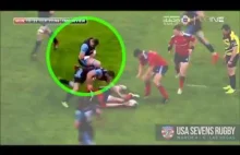 Rugbysta nastawia sobie wybity obojczyk