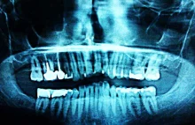 Dentystka usunęła pacjentce 22 zdrowe zęby!