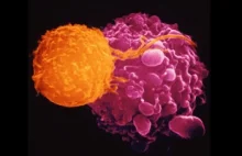 Zatwierdzono sposób leczenia raka przy pomocy genetycznie modyfikowanych wirusów