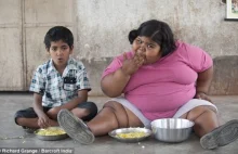 Ma 6 lat i waży 91 kg - Suman Khatun, najcięższa dziewcznka na świecie.