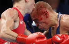 Rosyjski bokser wycofany z walki o finał. "Jego twarz jest w opłakanym stanie"