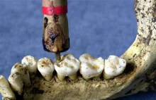 Dawne narzędzia dentystyczne
