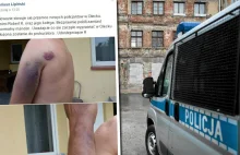 Twierdzi, że został pobity w radiowozie. Policja odpowiada: Był pijany i...